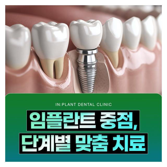 임플란트 중점, 단계별 맞춤 치료로 더 정확하고 안전하게